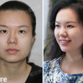 发腮是什么意思,时疫邪毒侵袭，腮部肿胀疼痛的瘟疫之症