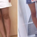 小孩怎样瘦腿,科学瘦腿方法指南